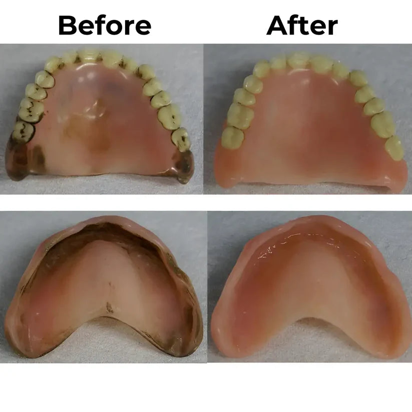 Denture Pod